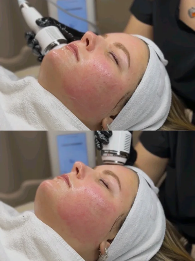 Korean Facial Behandlung – Detailarbeit