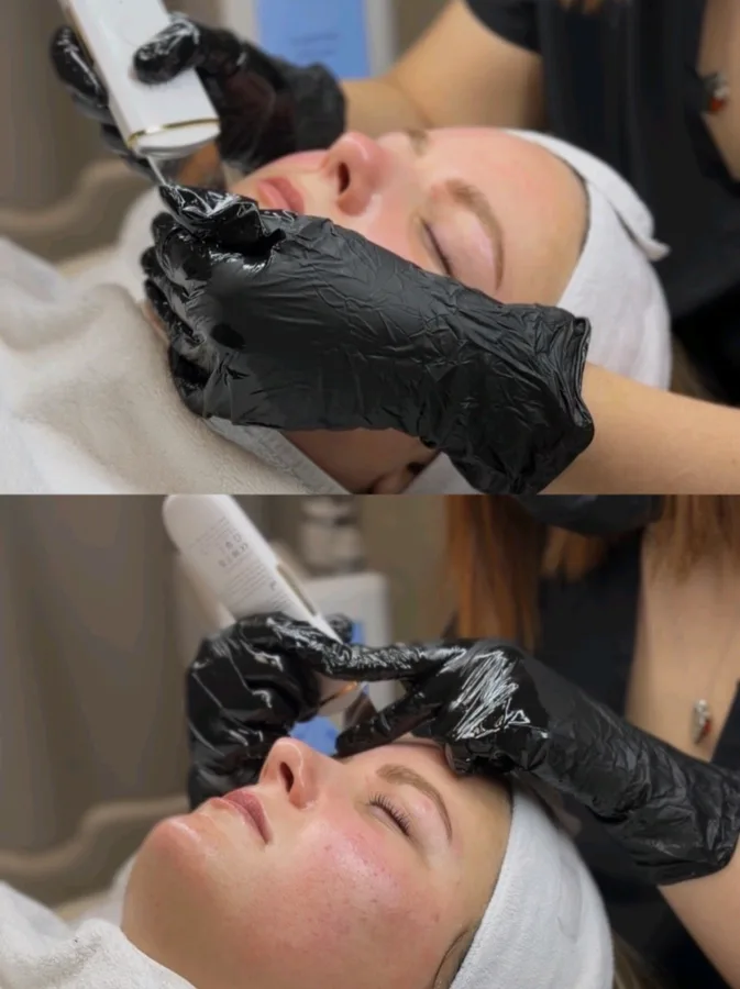 Apparative Kosmetik – Anwendung am Modell