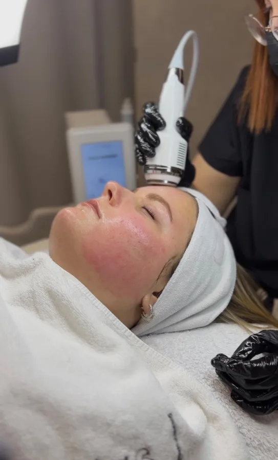 Korean Facial – Ergebnis