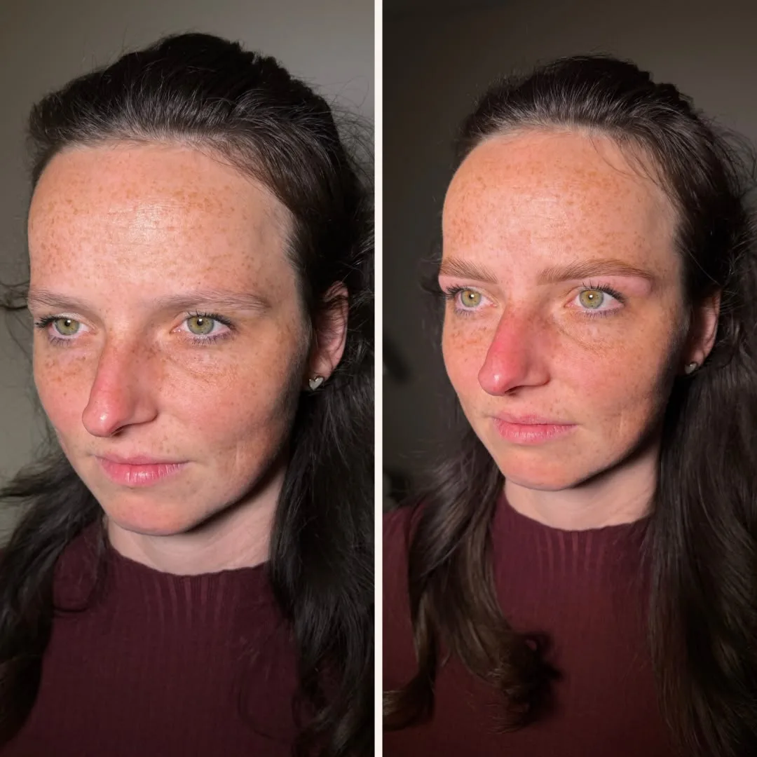Browlifting – Augenbrauen in Form gebracht